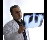 Understanding COPD